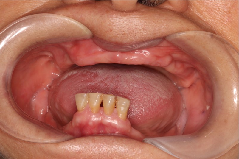 mouth1 mouth1