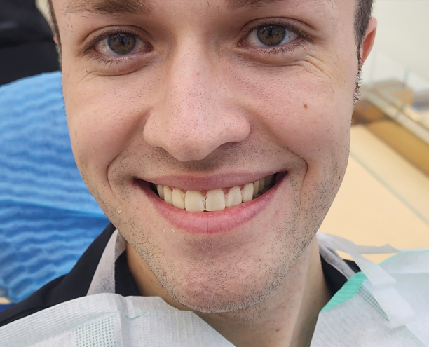 Fabrication of Provisional Resin Crowns2.png Fabrication of Provisional Resin Crowns2.png