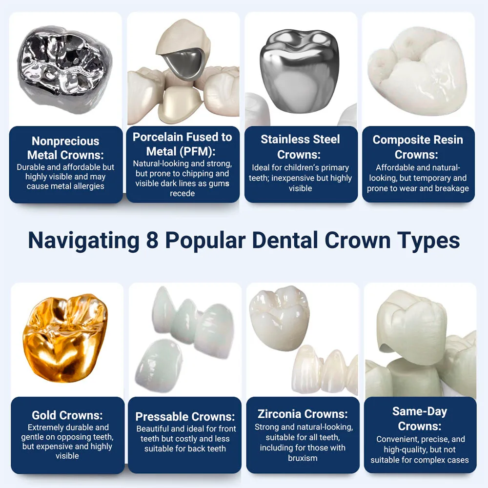 Navigating-8-Popular-Dental-Crown-Types