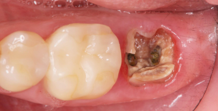 image004.png image004.png