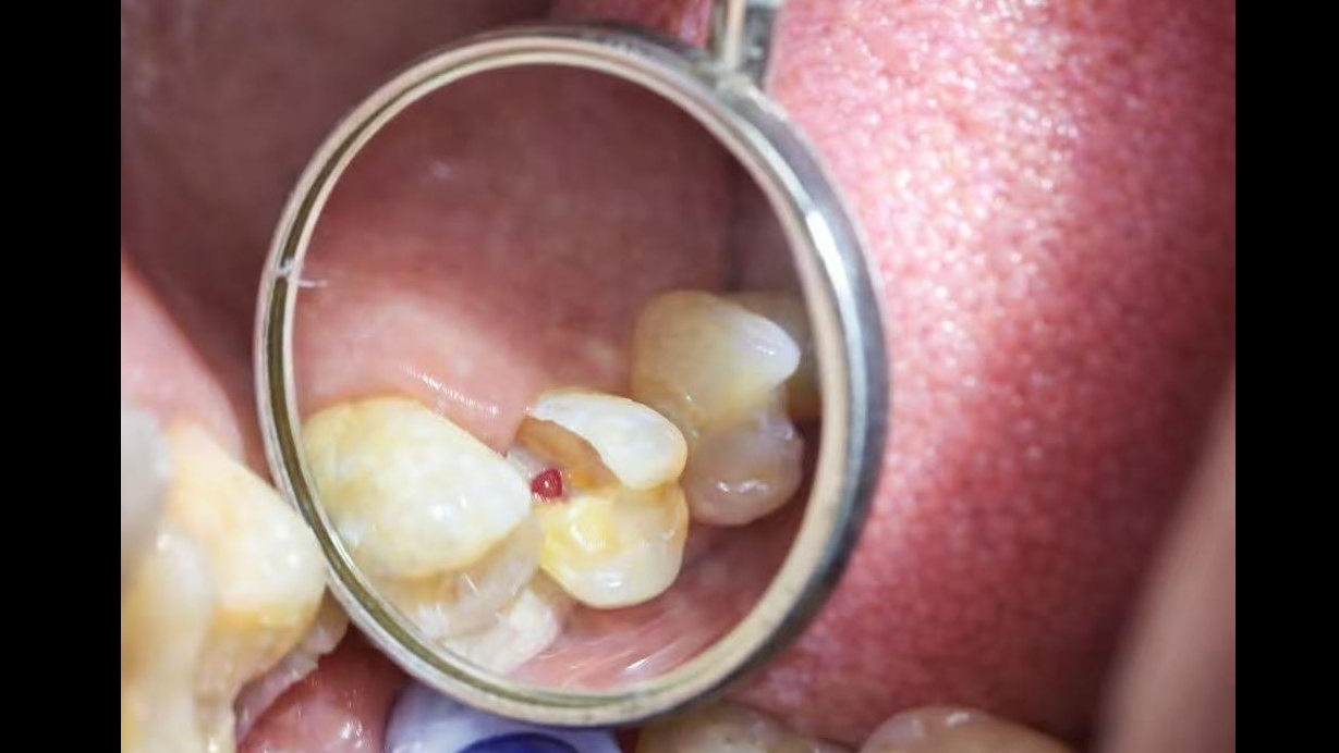 Weixin Image_20260105112203_73_41 Weixin Image_20260105112203_73_41