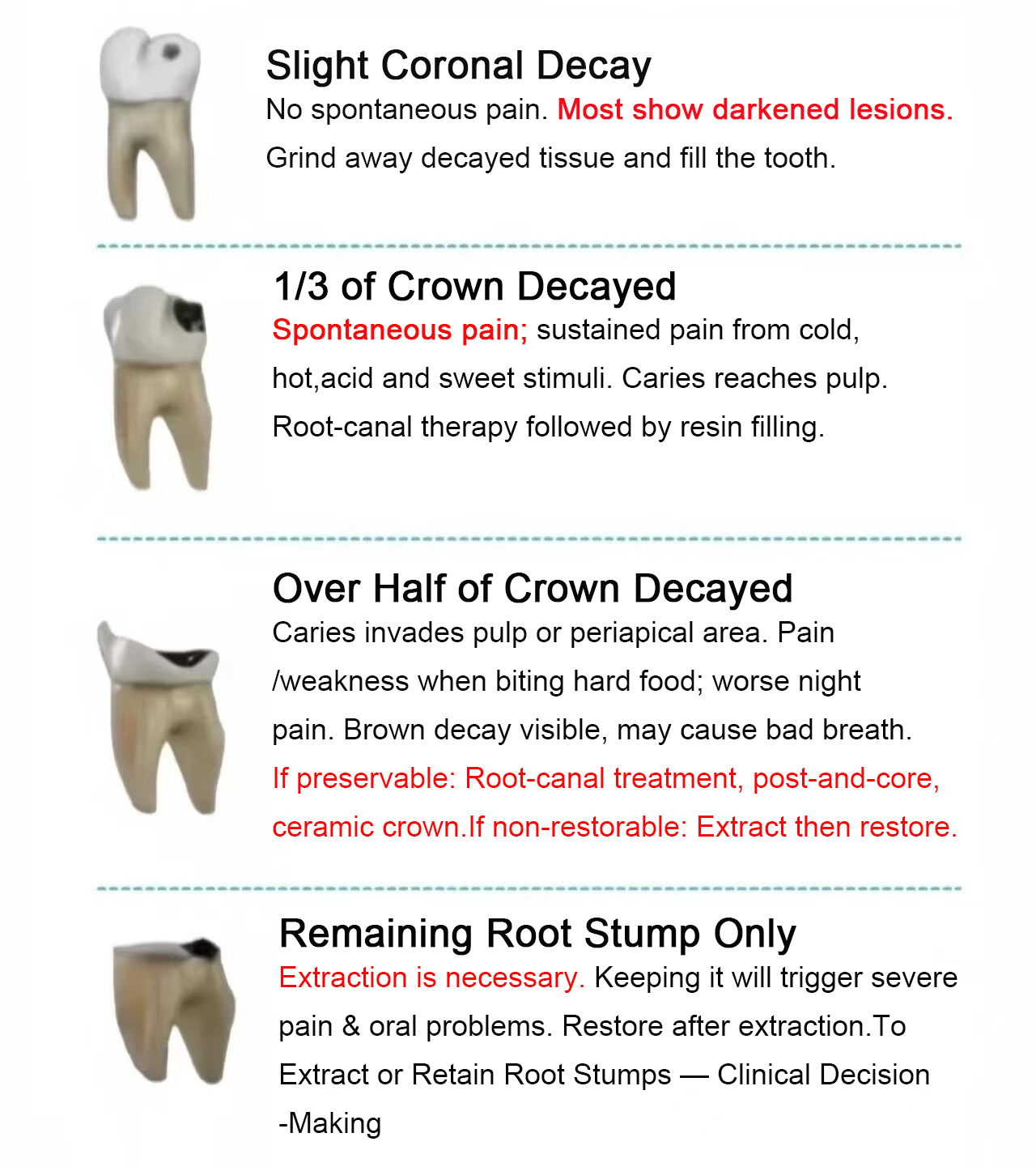 Decal-Root-Canal